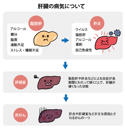 【まとめ】 肝臓 に 悪い もの ファン必見の最新情報 #673