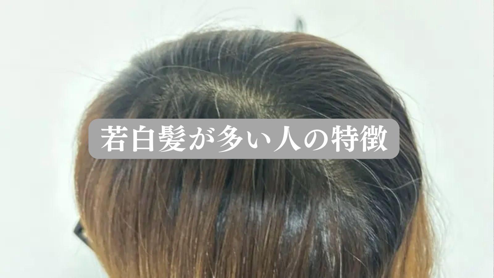 若白髪が多い人の特徴と決定的な共通点！原因から改善策まで徹底解明