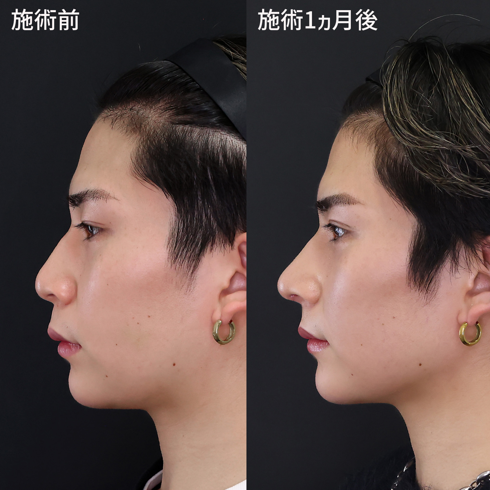 「豚鼻なのにかっこいい」の真相！愛されイケメンの黄金比と人気芸能人