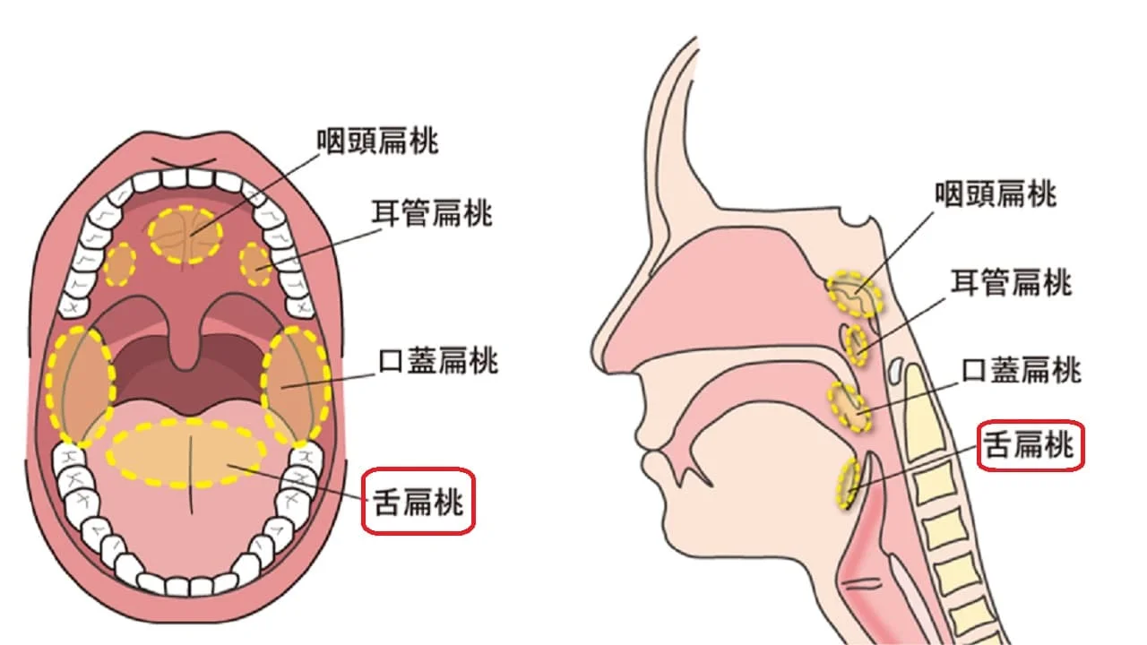 舌の奥のブツブツは放置Ok？有郭乳頭と危険な病気の決定的な見分け方