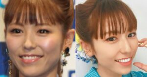 【経歴】 若槻 千夏 顔 変わっ た 公式インスタ・X最新情報 #931