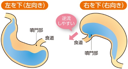 お酒の翌日に関節が痛む理由とは？二日酔いと放置できない危険なサイン